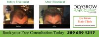Do Grow Hair Clinic image 7
